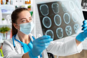 Coup-Contrecoup Injuries from Car Accident in Missouri